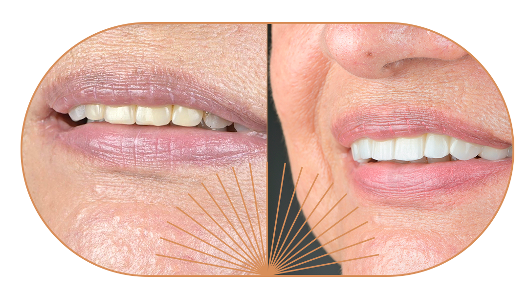 JenO-Bannertestimonios