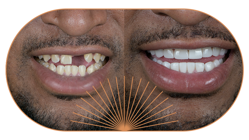 JenO-MediumBanner-Implantes